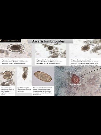 Understanding Stool Analysis: Microscopic and Macroscopic Exam