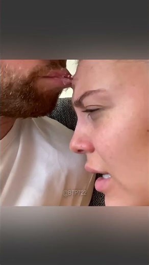 Super Glue on Skin Explained: Safe Removal Methods, Cyanoacrylate Science & Step-by-Step Guide