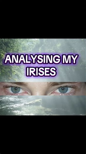 primal sonne on Instagram: "This is just the basics #iridology #aajonusvonderplanitz #naturalliving #primaldiet #viral"