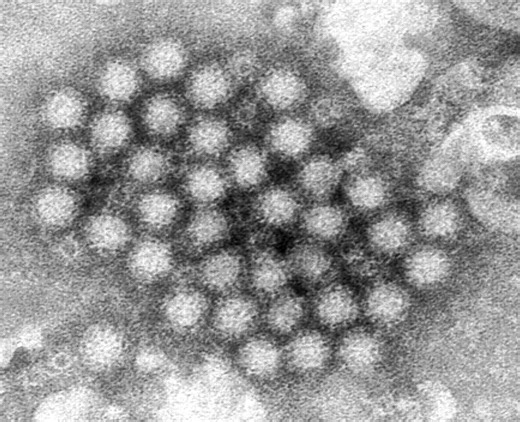 Norovirus vaccine: How does the trial work, when could it be available and what will it mean for the NHS?