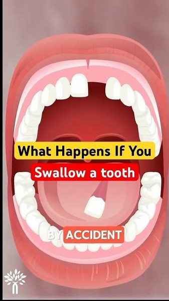 What Happens If You Swallow a Tooth 🦷 #short #viralvideo - LearningMavericks