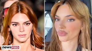 246K views · 2.8K reactions | Kendall Jenner Shows Off PUFFY Lips & The Internet Speculates About Fillers! | Clevver | Facebook
