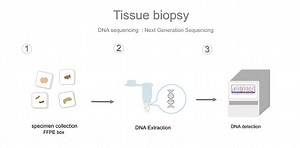 The workflow of DNA sequencing in the sample of tissue biopsy with...