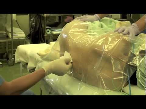 今週の硬膜外麻酔2例＋脊髄くも膜下麻酔1例 epidural & spinal anesthesia by Dr.EpiCal