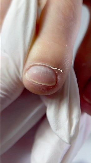 Pedicure Transformation Magic #aestheticnails #beforeandafternails #cleanpedicure