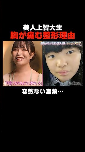 美人上智大生の胸が痛む整形理由…整形女子たちの恋リア「#シリコンズラブ」スタート💉🩷｜📢 #愛のハイエナ シーズン5毎週火曜23時〜無料配信中！ #shorts #整形