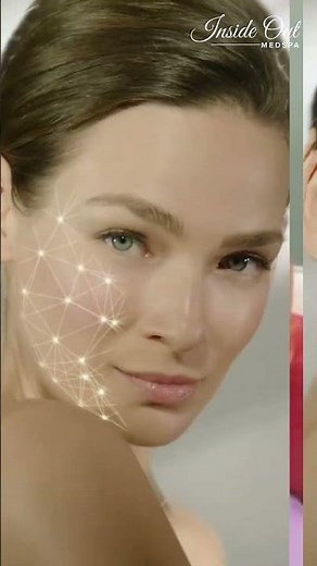Say goodbye to fine lines!👩🏻 Smooth away the marks of time with our Xeomin treatment