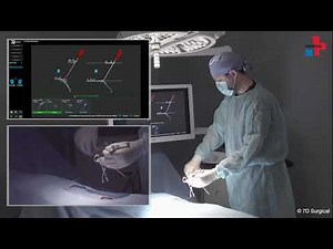 Machine Vision – The new navigation for spine surgery