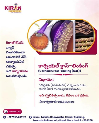 Corneal Cross-Linking (CXL) Treatment for Keratoconus | Advanced Eye Care in Mancherial