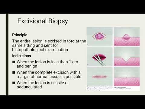 What is Biopsy? Types, Procedure & Risks Explained | Medical Education