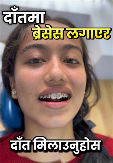 Braces Treatment Options in Nepal