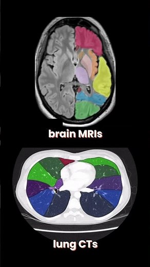 Revolutionizing Healthcare with Medical Image Annotation & Segmentation | Pareidolia Systems LLP