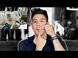 DOUBLE JAW SURGERY - 2 YEARS POST OP! (COST $$$, CHIN IMPLANT, NUMBNESS?) F.A.Q | JAIRWOO