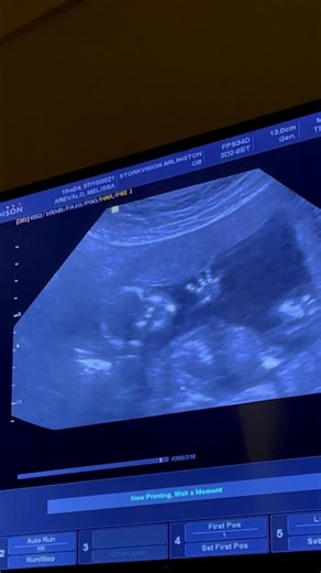 El mejor regalo del mundo 🌍❤️🥰 Julio ya llega pórfis. #16weekspregnant #july2021