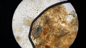 Otodectes Cynotis Ear Mites Under Microscope Stock Footage Video (100% Royalty-free) 1105175983 | Shutterstock