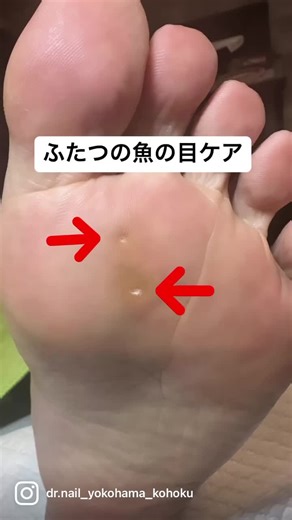 痛くない施術で奇跡のフットケア体験