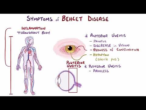 Behcet disease causes, symptoms, diagnosis, treatment, pathology