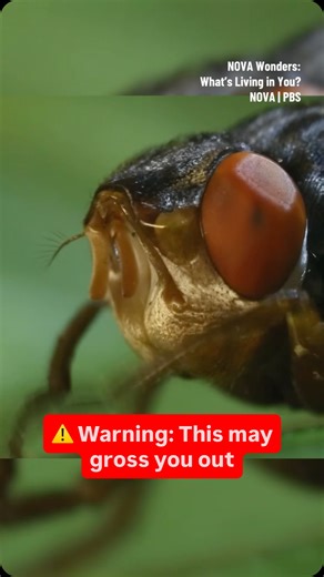 Meet the researcher who raised a botfly in his arm… 🪰 #gross #larva #entomology #stemtok | NOVA l PBS