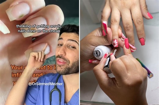 Acrylic nails could cause ‘nightmare’ infection that turns nails green, doctor warns