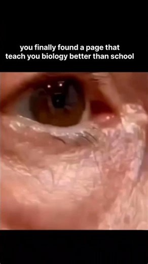 eyes 👀 Kyun Fadakti Hai?The Science of Eye Twitching#shorts