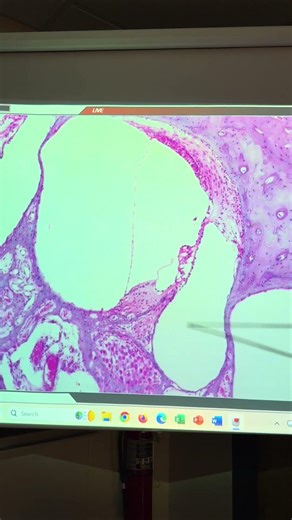 BIOL 157 Cochlea Slide