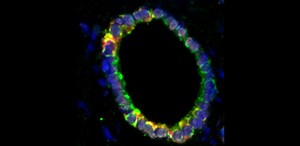 Lab-grown ‘mini-bile ducts’ used to repair human livers in regenerative medicine first