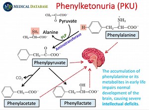 1.5K views · 12 reactions | Phenylketonuria is the most common clinically encountered inborn error of metabolism of amino acid metabolism. Early diagnosis and management are crucial to prevent mental retardation. Learn more on diagnostics and screening tests at our Laboratory Decision System - https://app.medicaldatabase.com/site/diseases/559e25c6-c1b6-4c55-8f48-f39336994ebe | Medical Database | Facebook