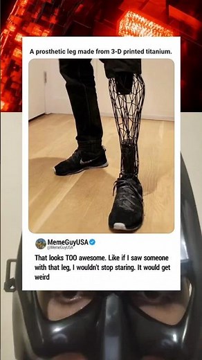 3D Printed Titanium Prosthetic Leg