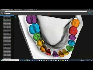 Fully-automated 3D teeth segmentation by deep learning