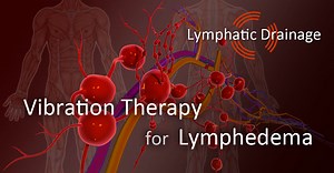 Vibration Therapy for Lymphedema [Science & Practice]