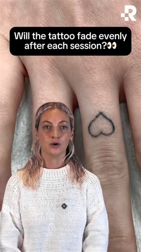 The World’s Tattoo Removal Experts on Instagram: "Do tattoos fade evenly? 👀 Different colors and ink depths respond uniquely to the laser energy. This can lead to uneven fading after your initial sessions. Don't worry! This unevenness always balances out over the full course of treatments, resulting in smooth, clear skin. It's just part of the process! #removery #lasertattooremoval #tattooremoval"