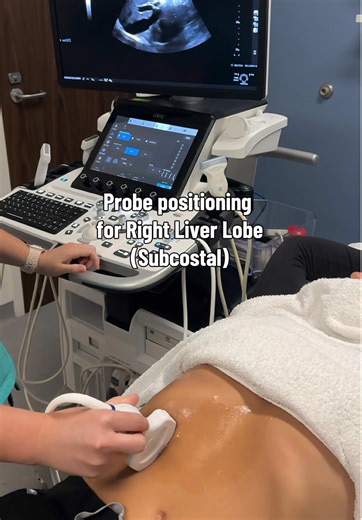 Probe positioning for Right Liver Lobe (SUBCOSTAL) #sonographyschool #ultrasoundtech #ultrasound #sonographer #ultrasoundschool