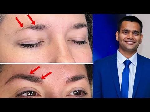 How To Grow Thicker Eyebrows Naturally and Faster | Dr. Vivek Joshi