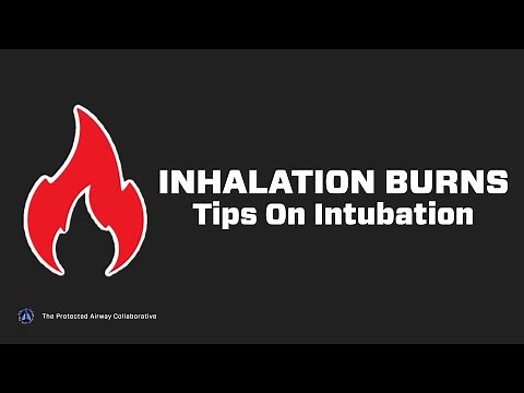 How to Successfully Intubate a Patient with an Inhalation Burn to the Upper Airway