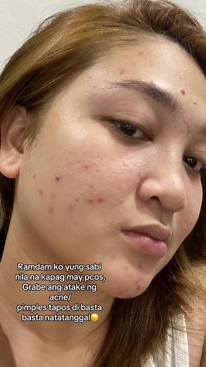 Achieve Flawless Skin with Beauche Beauty Bar Soap