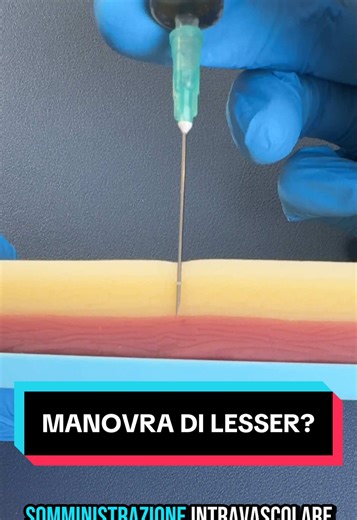 Manovra di Lesser: Perché non è più raccomandata?