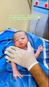 The Moro reflex is often called a startle reflex. That's because it usually occurs when a baby is startled by a loud sound or movement. In response to the sound, the baby throws back their head, extends out their arms and legs, cries, then pulls the arms and legs back in. #educational #mororeflex | Neng Glenda