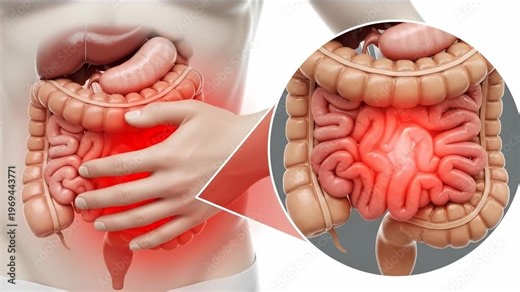 Abdominal discomfort, a severe intestinal disease, depicting inflamed bowel and painful digestive system issues, requiring urgent medical diagnosis and treatment