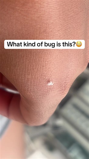 Identifying Uncommon Insects: What Bug Is This?