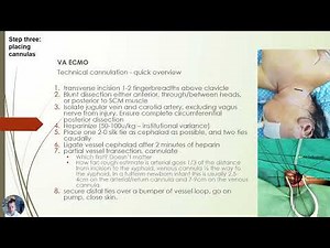 ECMO cannulation quick reference guide