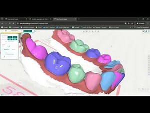 Diagnóstico Digital en Ortodoncia - Conoce Titan Design en menos de 5 minutos