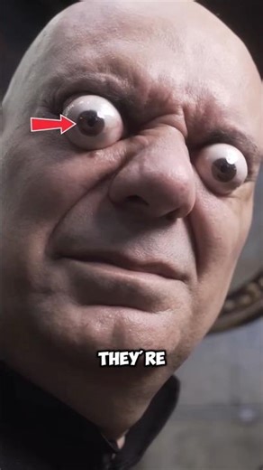 “Why Do Some Eyes Look Like They’re Popping Out? 👀😲🩺”