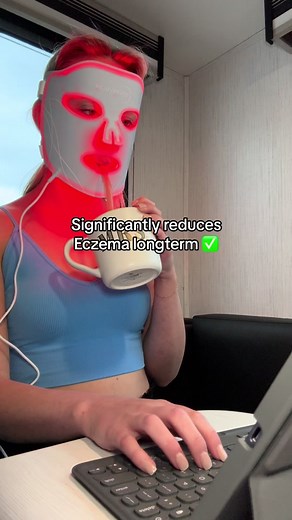 Red Light Therapy for Eczema: A Comprehensive Solution