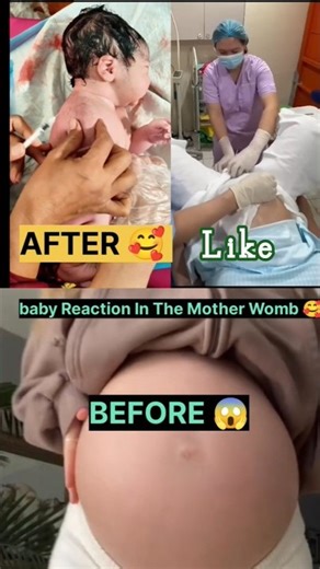 baby Reaction In The Mother Womb #shortsfeed #ultrasound #pregnancy #shortsfeed #viral#yt #babycare#