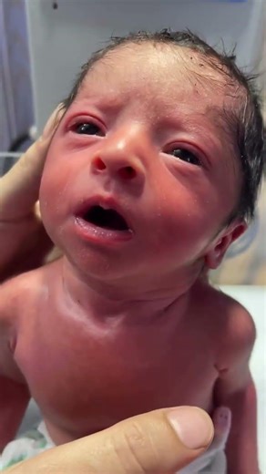Look cute baby facial expression 🥰 #baby #ultrasound #pregnancycare #shorts 💕