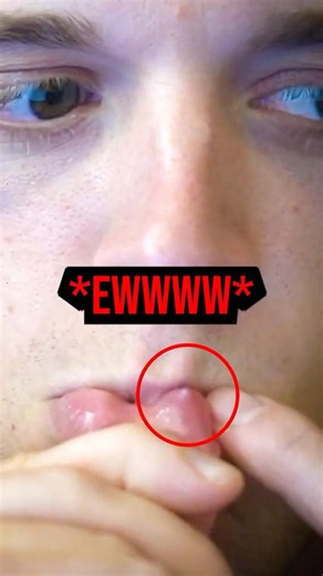 Joe Bart Went To The Doctors 😂