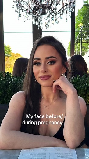 Pregnancy Face Changes - Before and After Weight Gain