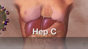 5.7K views · 118 reactions | It's estimated that 2 to 3 million...