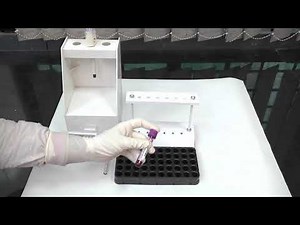 ESR by Wintrobe Method