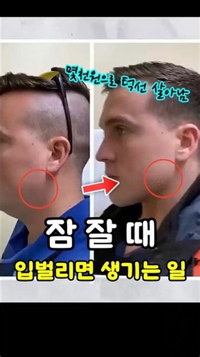 성형 없이 턱선 교정? 구강 호흡 완벽 차단하는 가성비 밴드